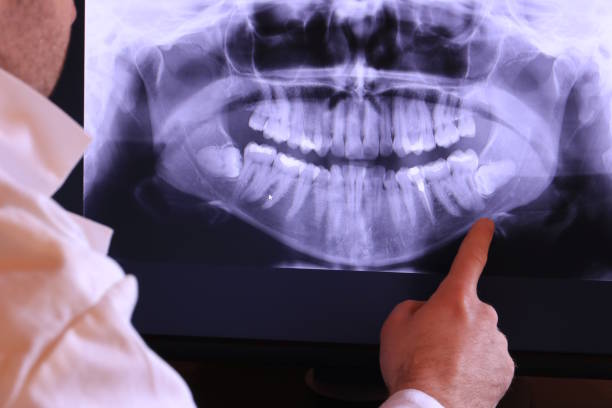 Best Emergency Broken Tooth Repair in Terry, MS
