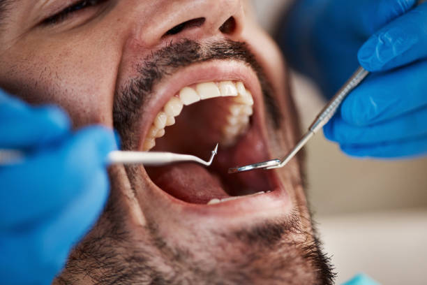 Best Urgent Dental Care in Terry, MS