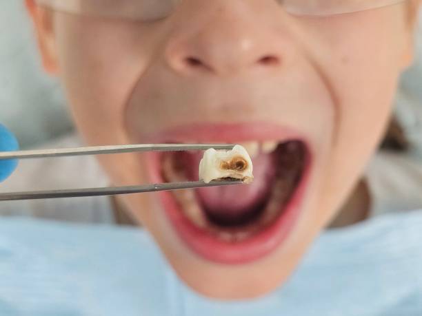 Best Pediatric Emergency Dentist in Terry, MS